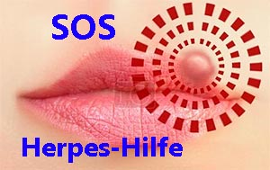 herpes hilfe