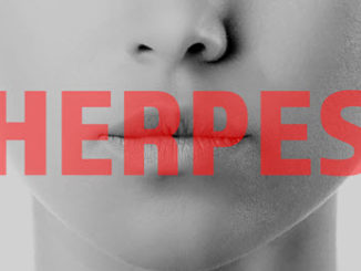 Herpes vorbeugen Lippenherpes richtige Mittel Hausmittel und Cremes gegen Herpesbläschen